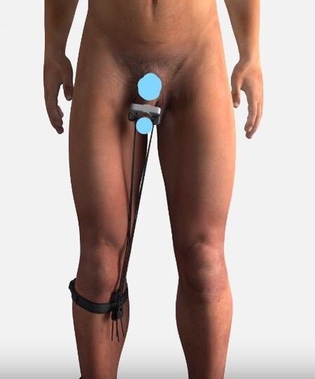 Device to enhance members