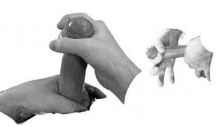 Penis wound to increase